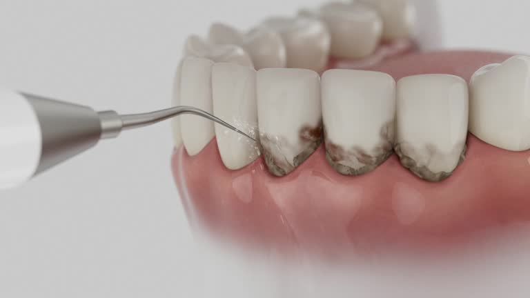 Reliable Root Canal Treatment contractor in Kidder County County, ND by Dentist Open Now